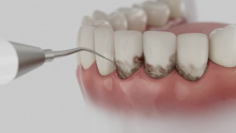 Trusted Invisalign Clear Aligners service in Stone Ridge, VA - Dentist Open Now